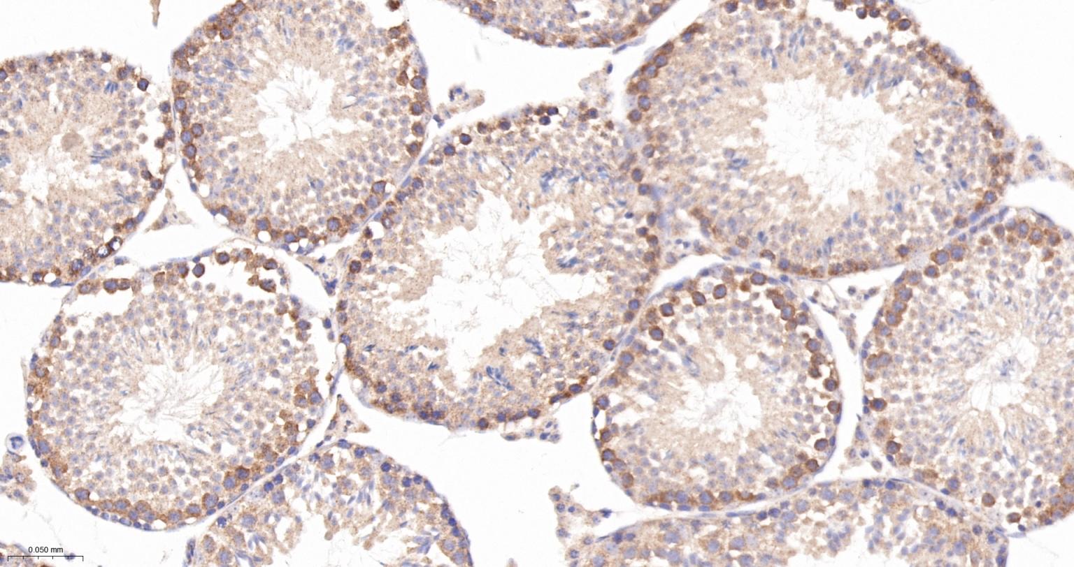 Ras GTP酶活化蛋白结合蛋白1重组兔单抗