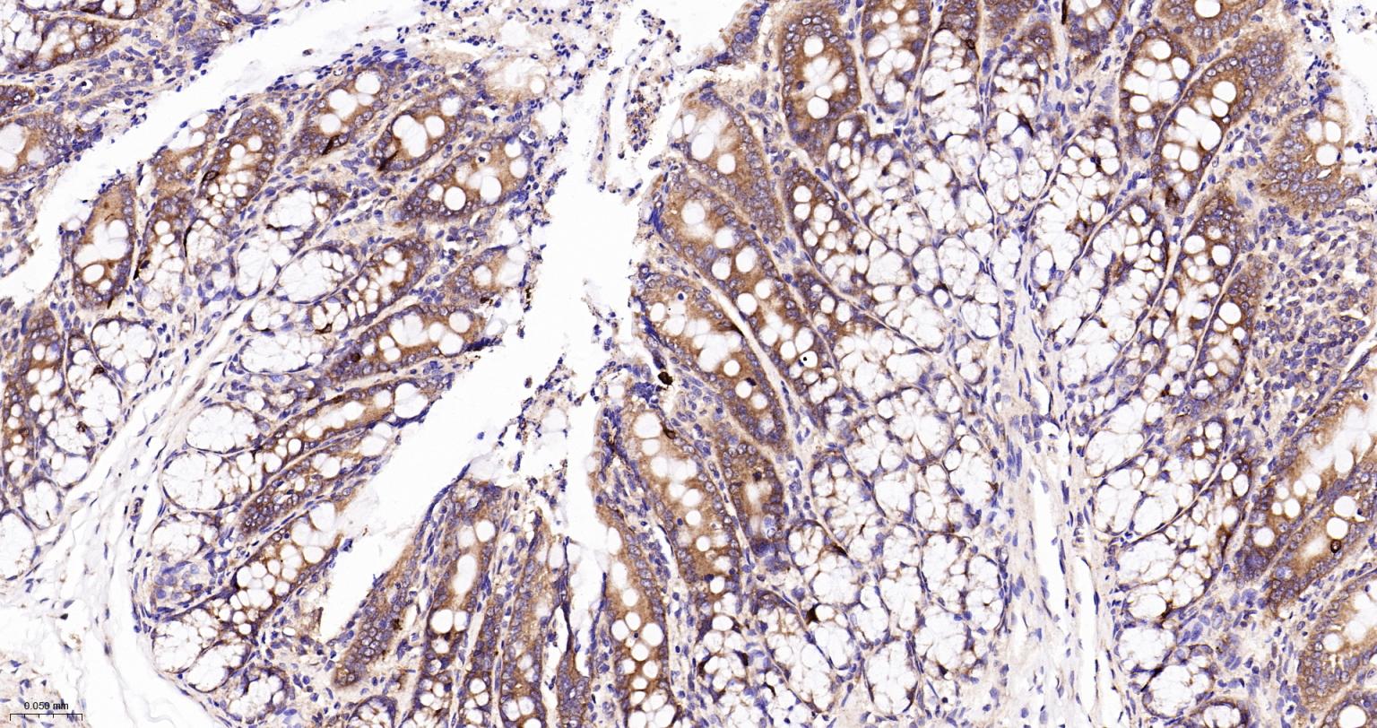 Ras GTP酶活化蛋白结合蛋白1重组兔单抗