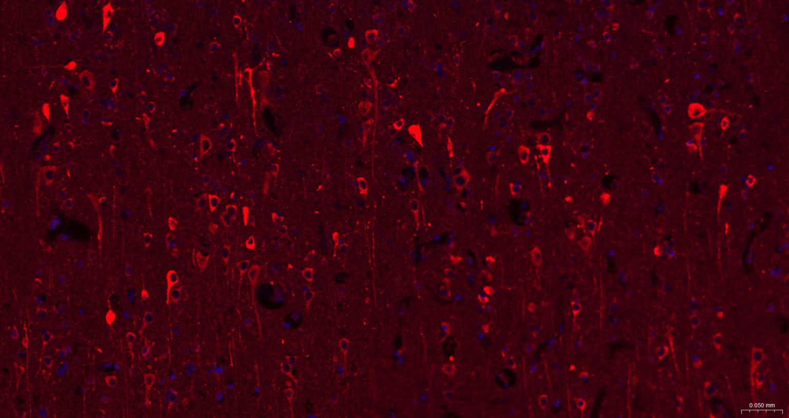 瘦素受体重组兔单抗