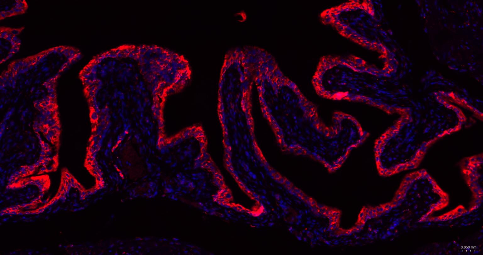 列腺素E2受体2重组兔单抗