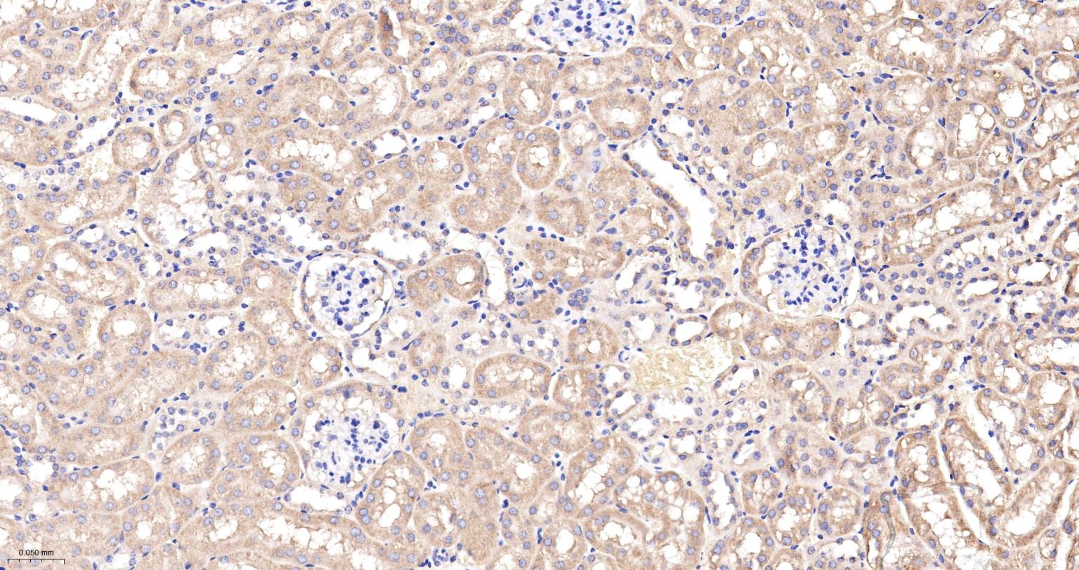 Ras GTP酶活化蛋白结合蛋白1重组兔单抗