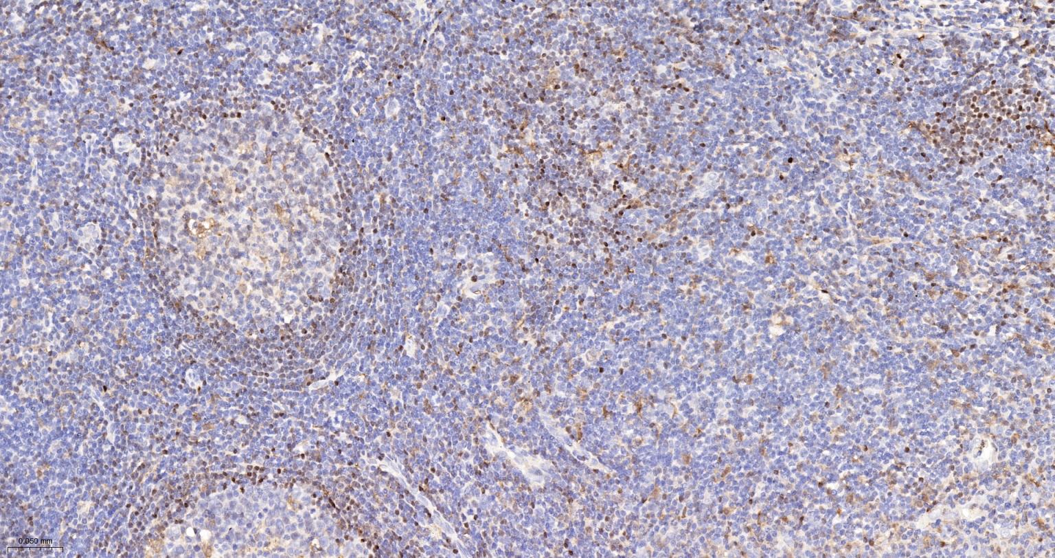 5-脂氧合酶重组兔单抗