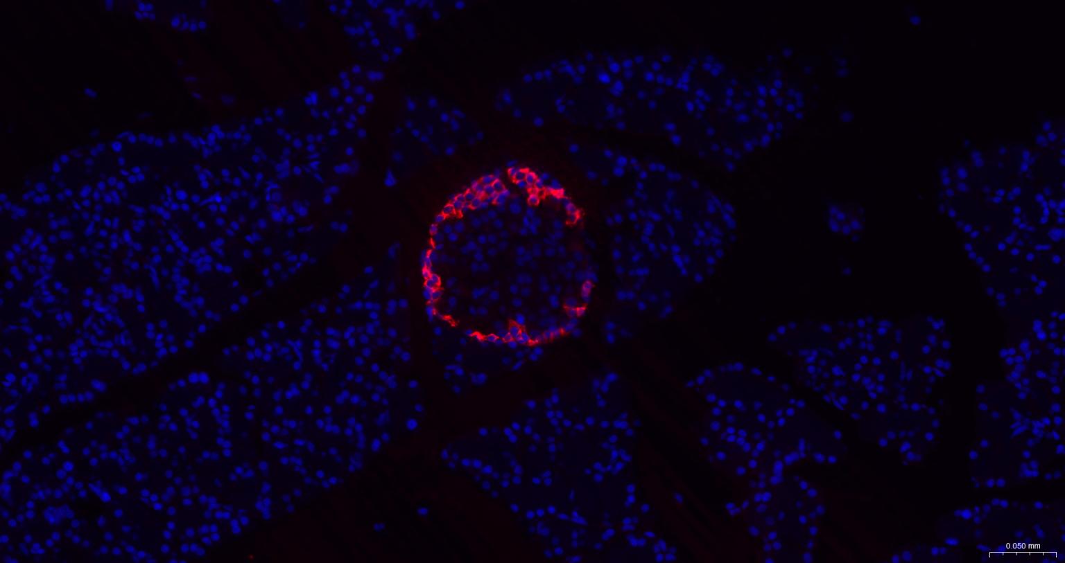 胰高血糖素重组兔单抗