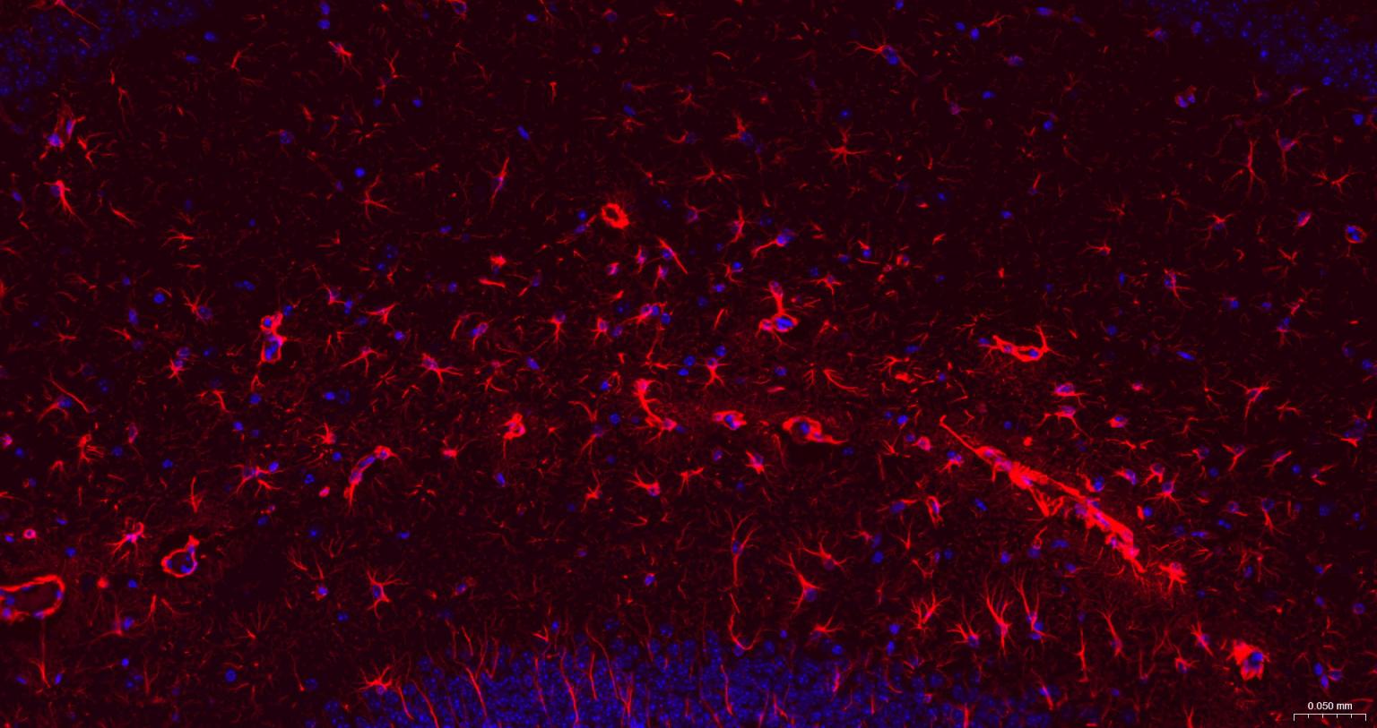 胶质纤维酸性蛋白重组兔单抗