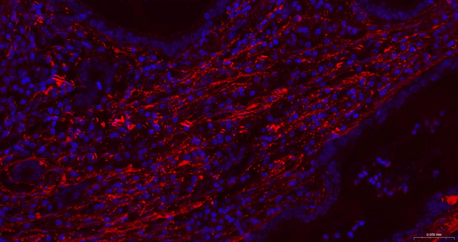 纤维连接蛋白重组兔单抗