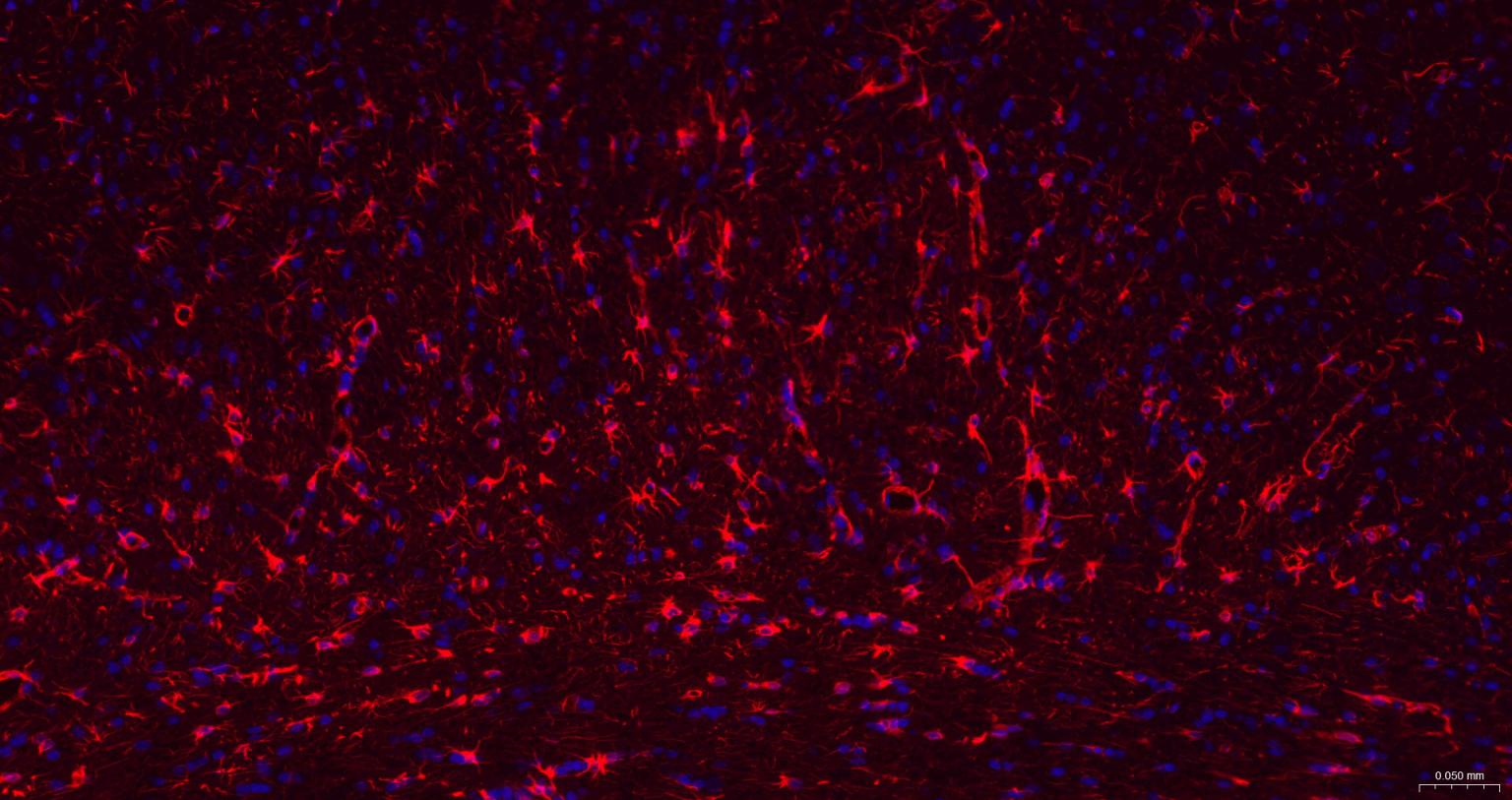 胶质纤维酸性蛋白重组兔单抗