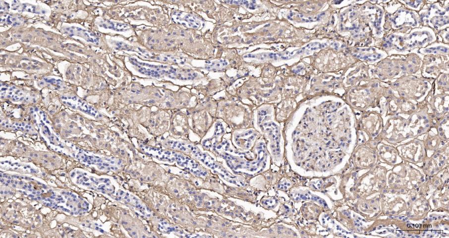 纤维连接蛋白抗体-bs-48086R