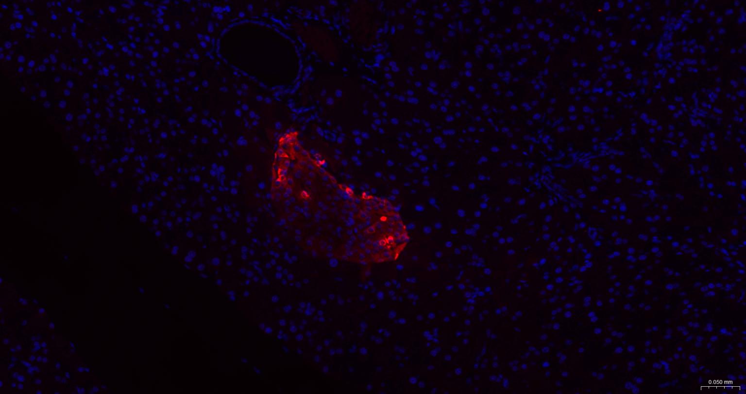 胰高血糖素重组兔单抗