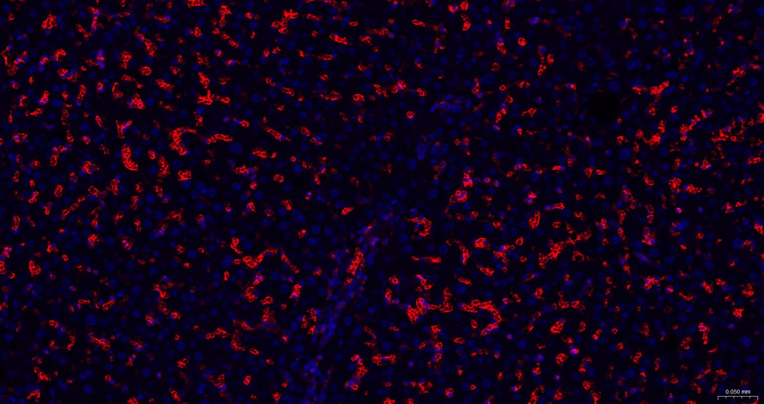 葡萄糖转运蛋白1重组兔单抗