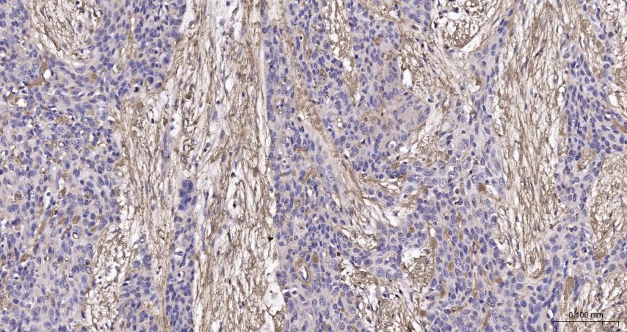 纤维连接蛋白抗体-bs-48086R