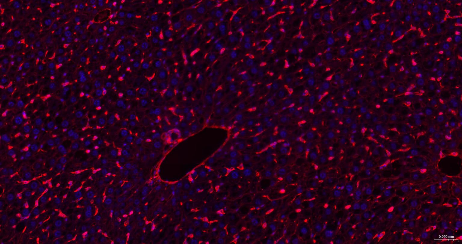 葡萄糖转运蛋白1重组兔单抗