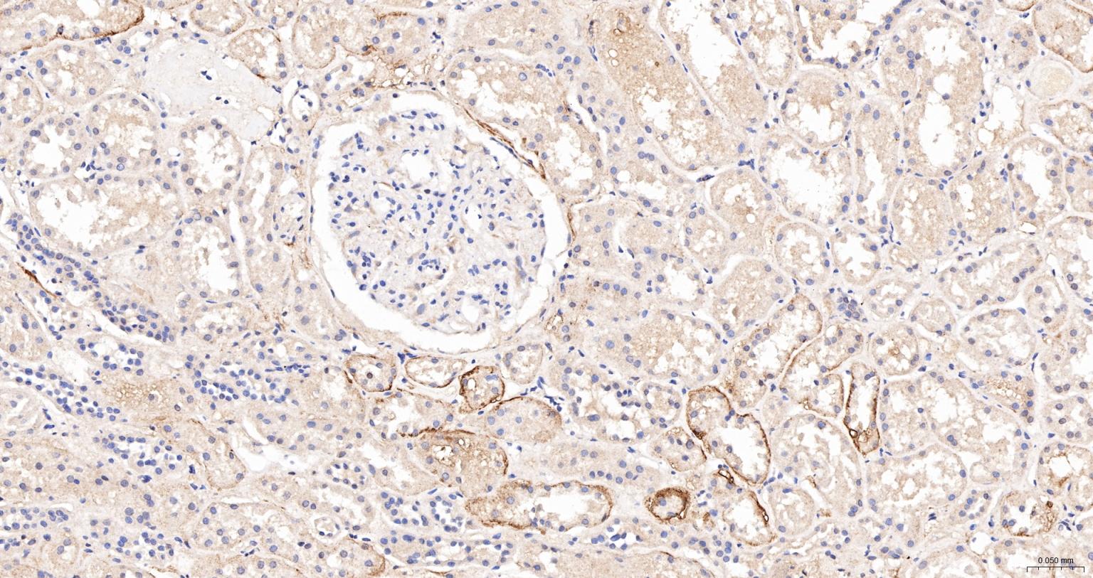 相关死亡促进因子Bad抗体-bs-0892R