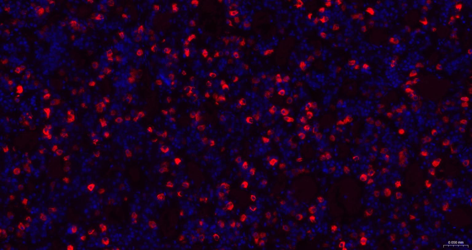 促卵泡刺激素重组兔单抗