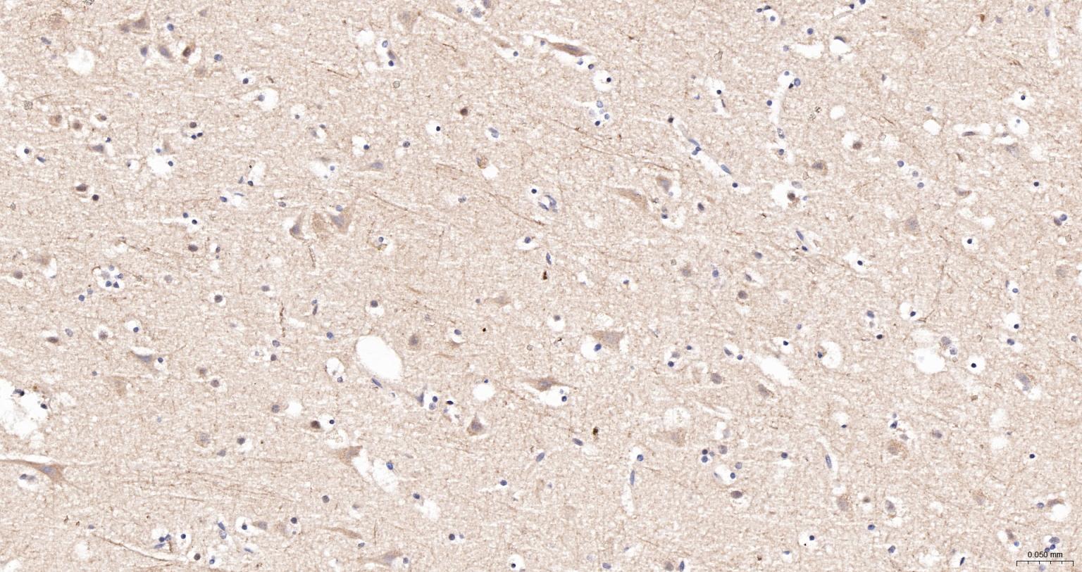 相关死亡促进因子Bad抗体-bs-0892R