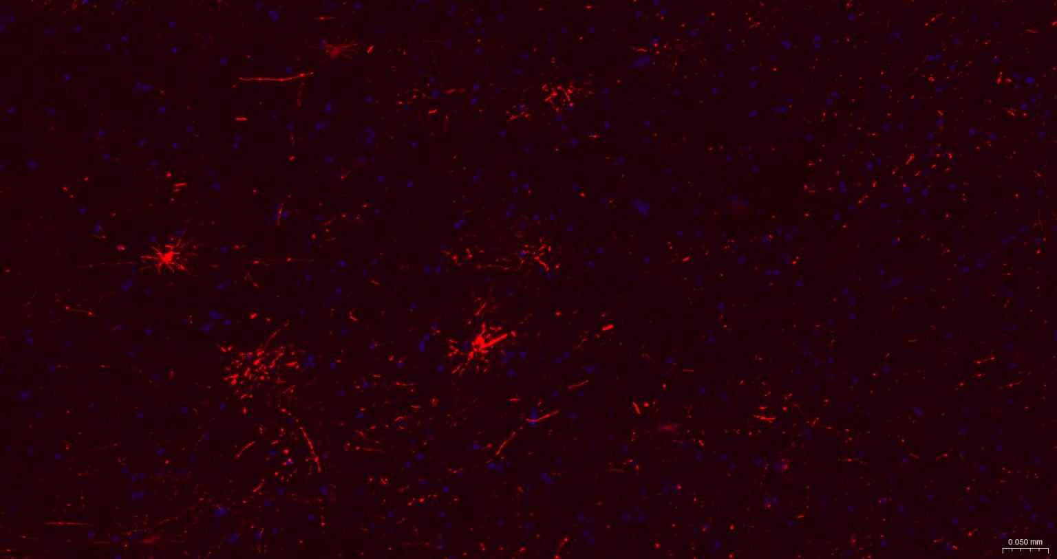 胶质纤维酸性蛋白重组兔单抗