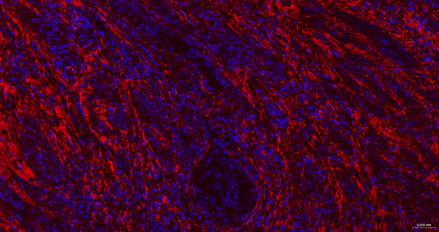 纤维连接蛋白重组兔单抗