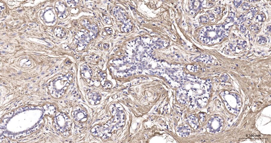 纤维连接蛋白抗体-bs-48086R