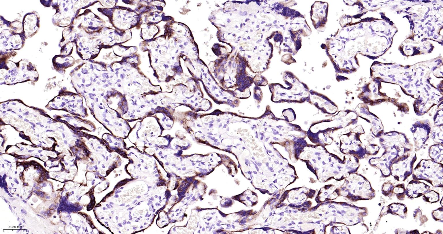 Human CG beta Mouse mAb (一抗) - IHC-P,IHC-F,IF | Bioss