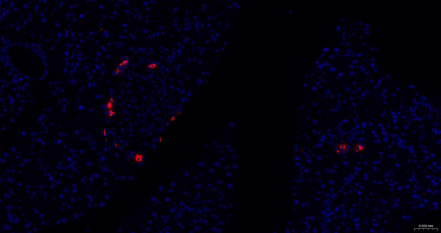 生长抑素重组兔单抗