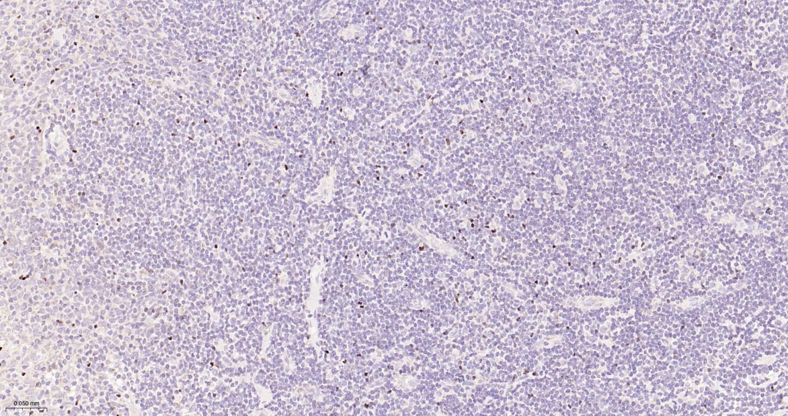 叉头蛋白P3重组兔单抗