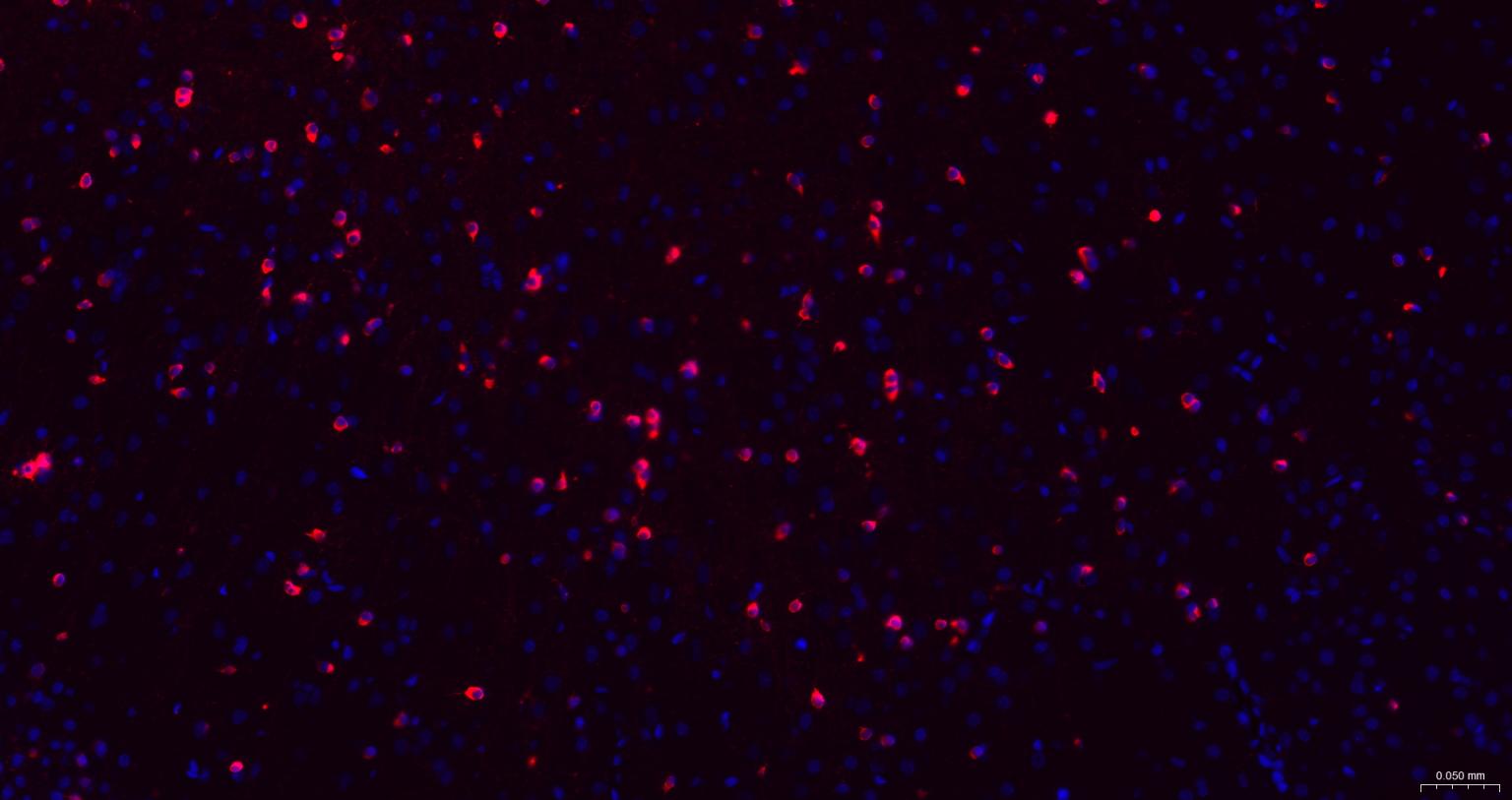 α晶状体球蛋白B/αB-crystallin重组兔单抗-bsm-61511R