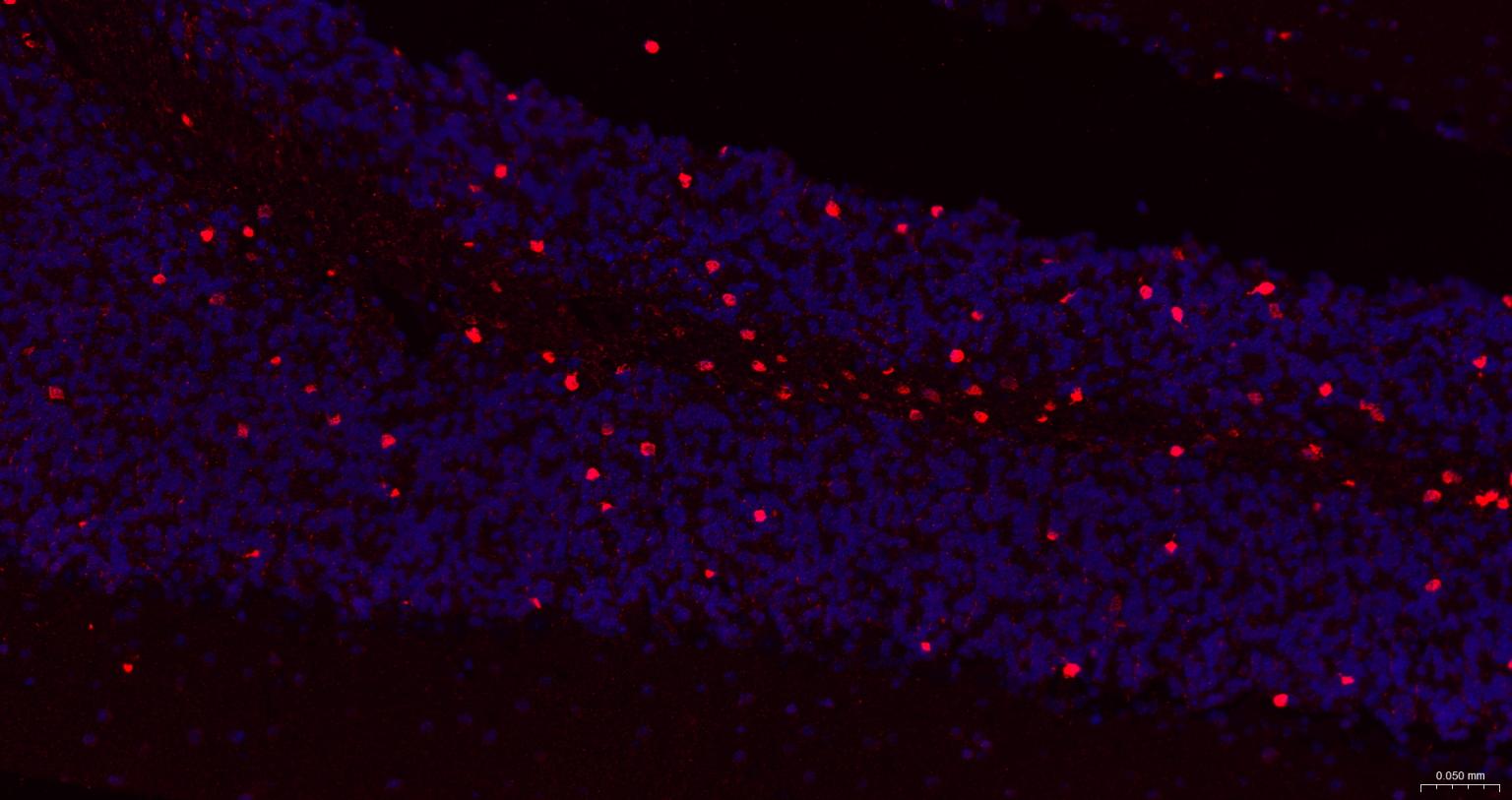 谷胱甘肽硫转移酶pi重组兔单抗