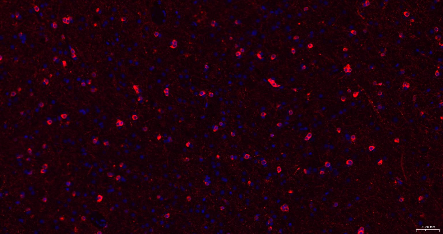 α晶状体球蛋白B/αB-crystallin重组兔单抗-bsm-61511R