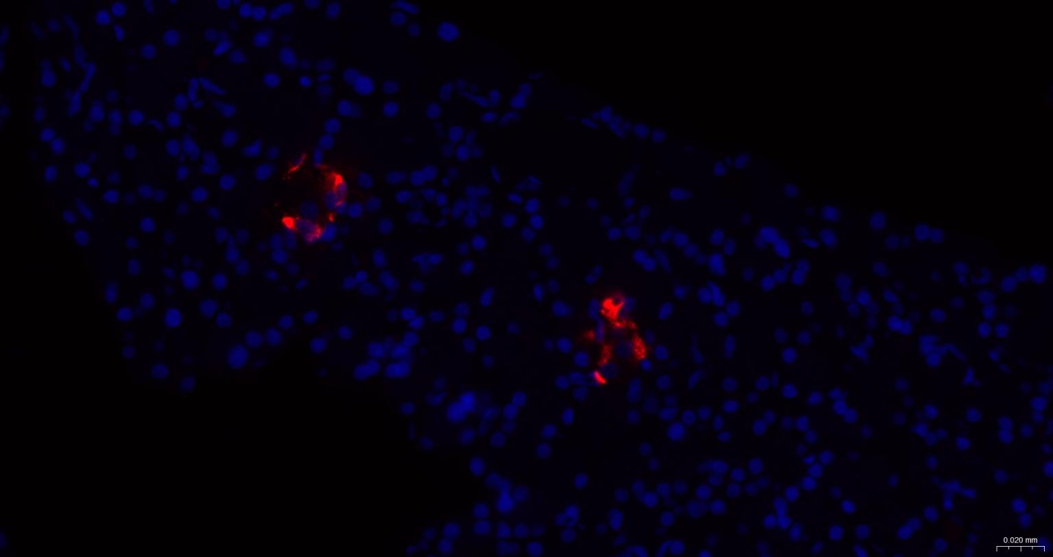 生长抑素重组兔单抗