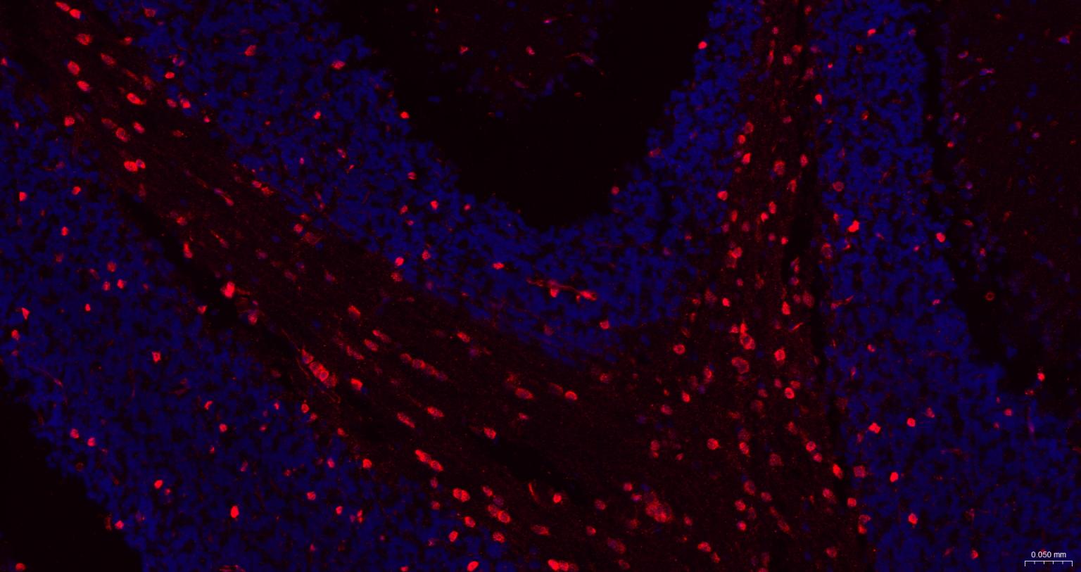 谷胱甘肽硫转移酶pi重组兔单抗