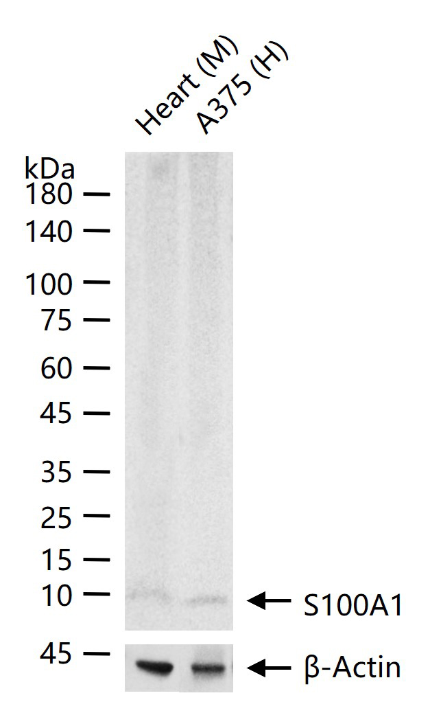 S100A1 Recombinant Rabbit mAb (一抗) - WB,IHC-P,IHC-F,IF | Bioss