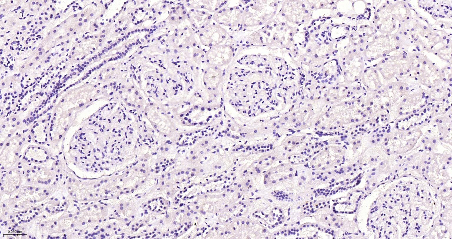 人绒毛膜促性腺激素β单克隆抗体-bsm-43172M