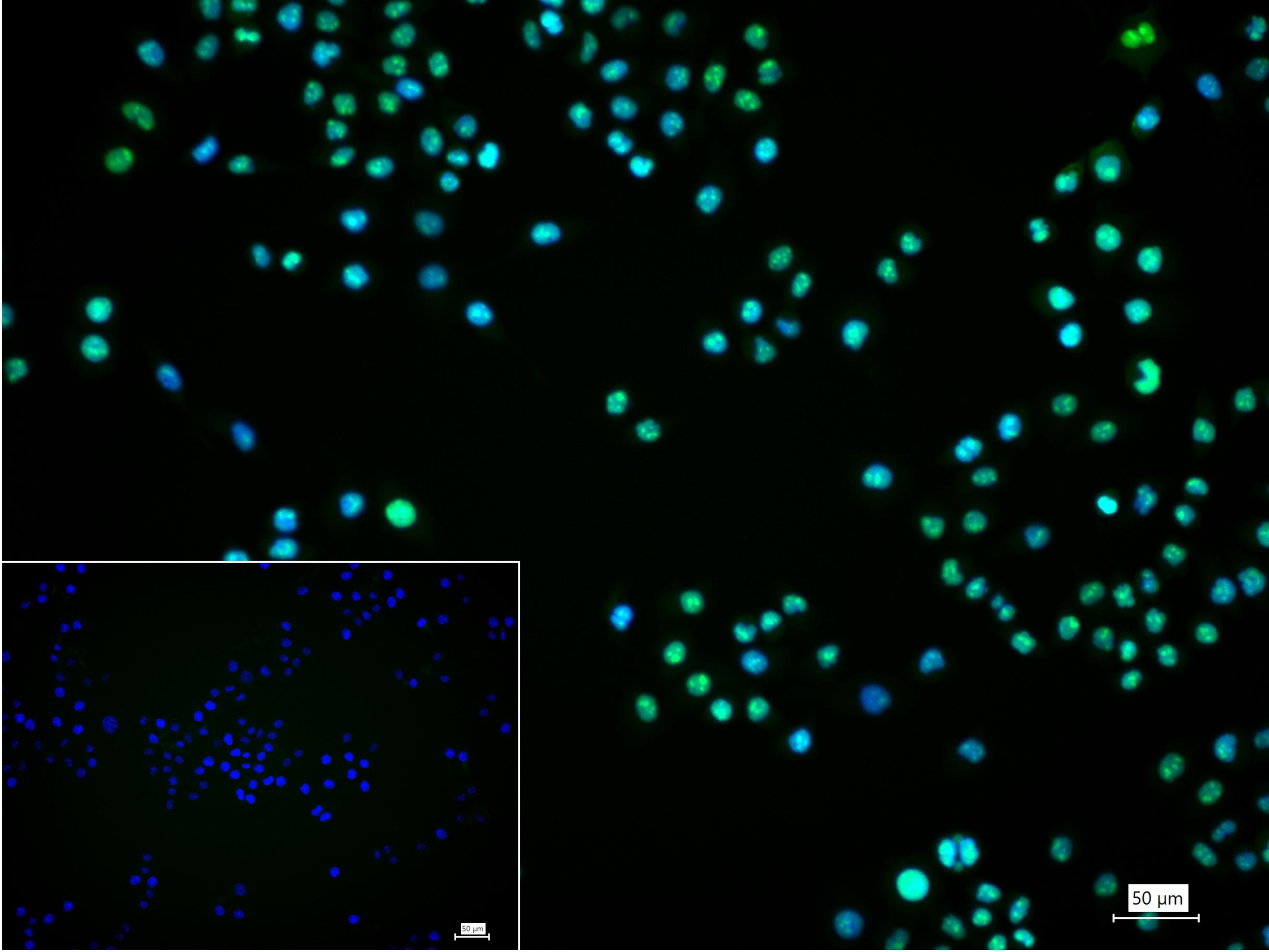 高迁移率族蛋白B1重组兔单抗