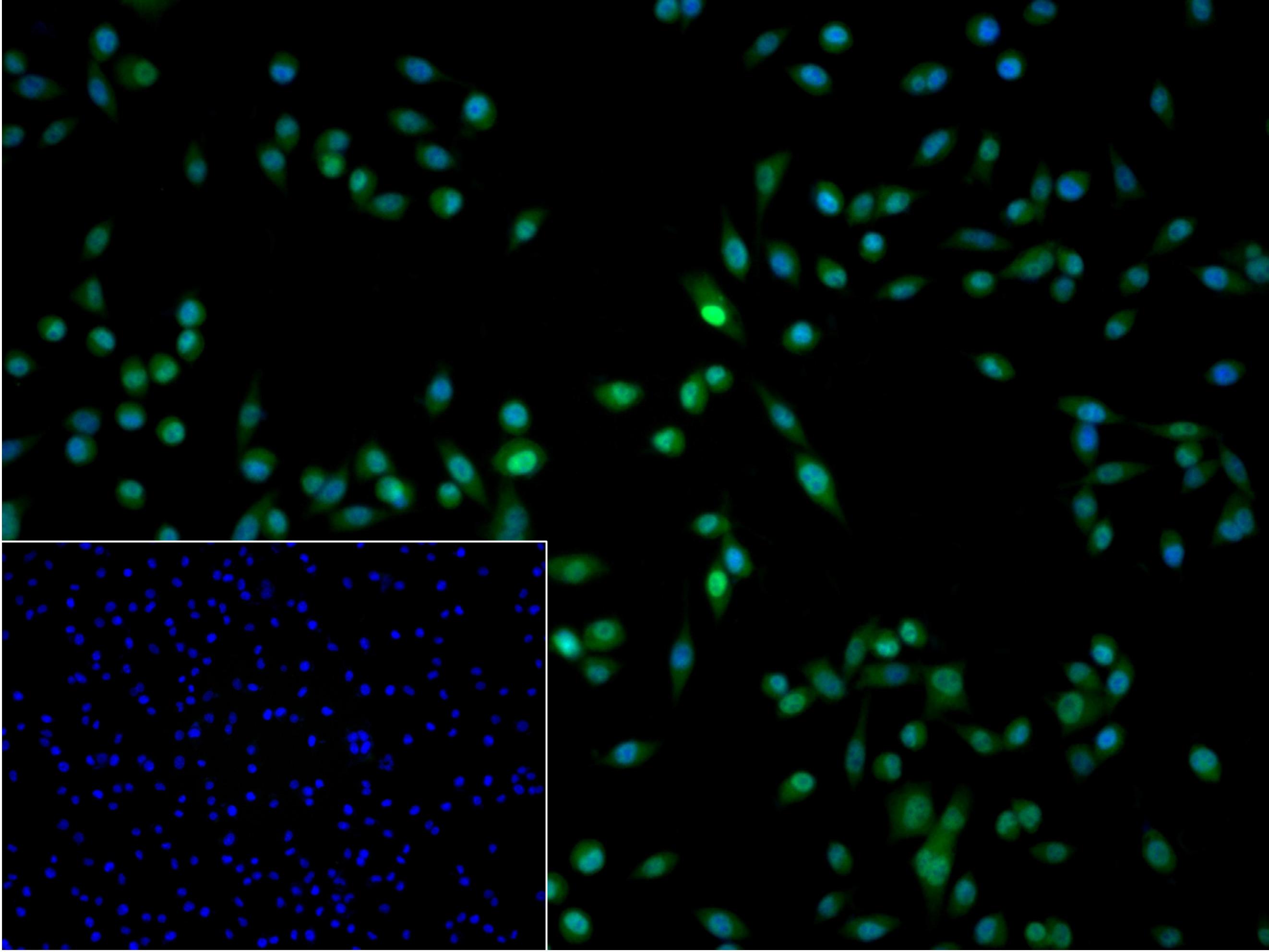 活化蛋白激酶B重组兔单抗