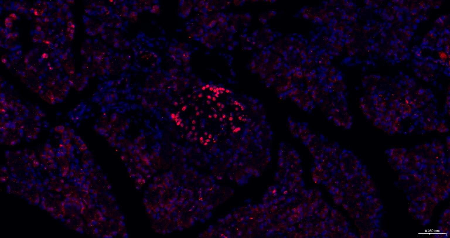 胰岛素基因增强结合蛋白1重组兔单抗