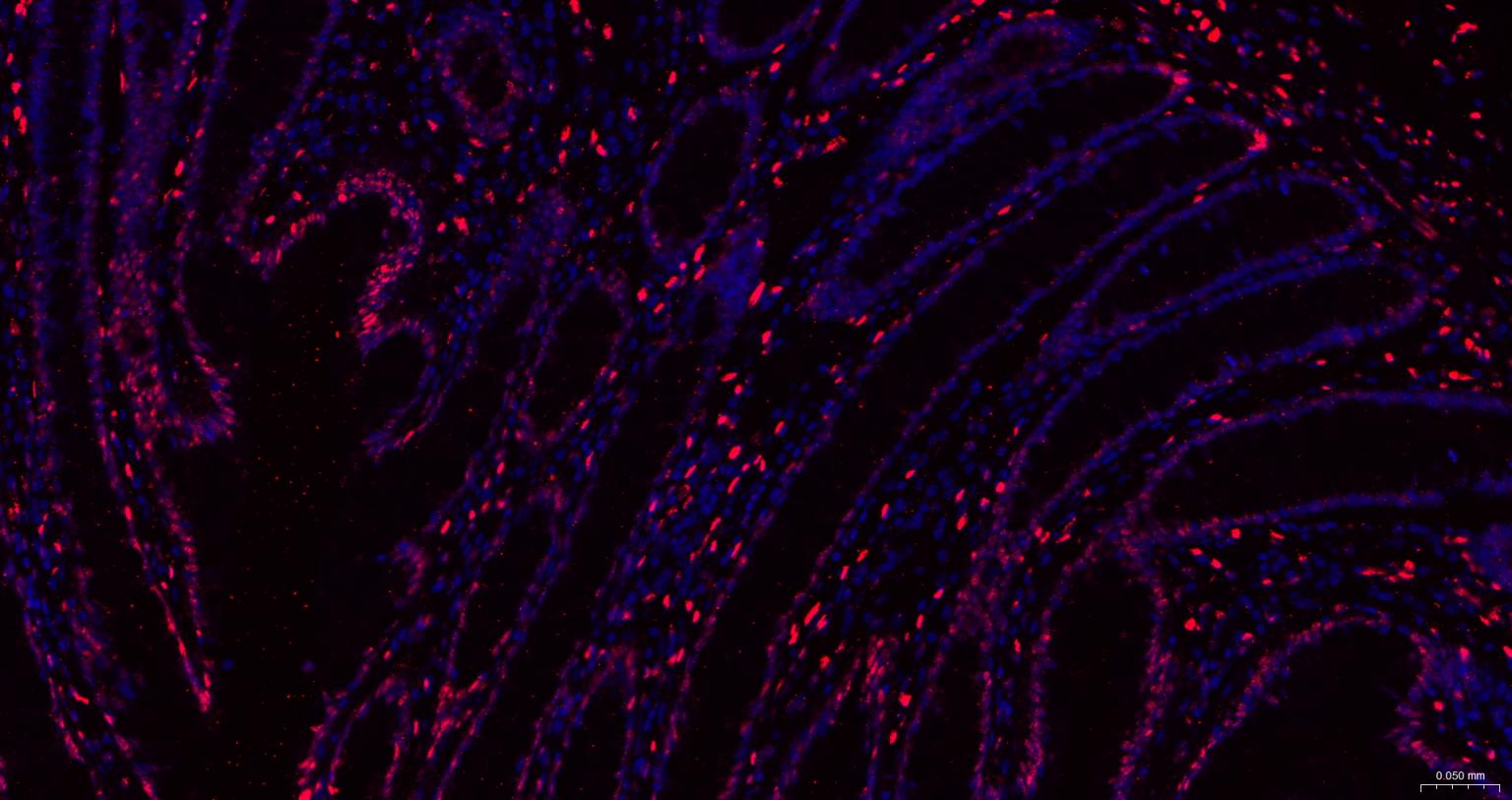 组蛋白H1.0重组兔单抗