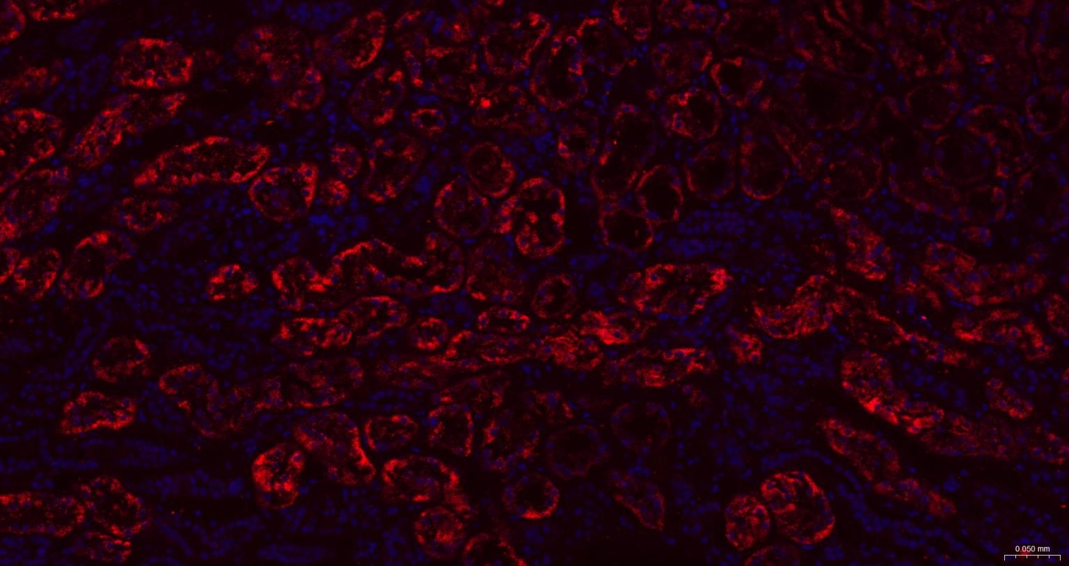γ氨基丁酸转氨酶重组兔单抗