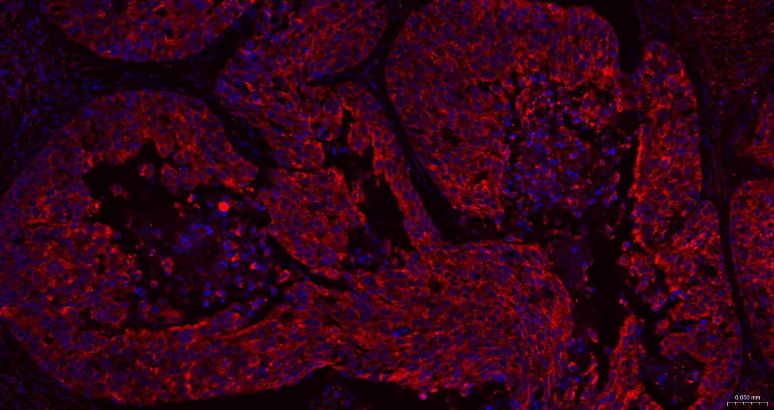BH3结构域凋亡诱导蛋白重组兔单抗