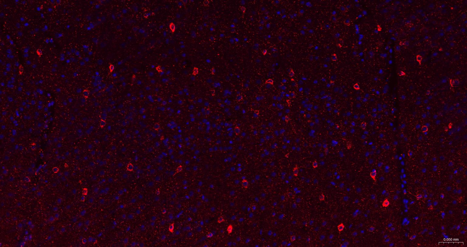 γ氨基丁酸转氨酶重组兔单抗