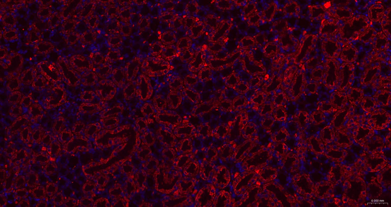 γ氨基丁酸转氨酶重组兔单抗