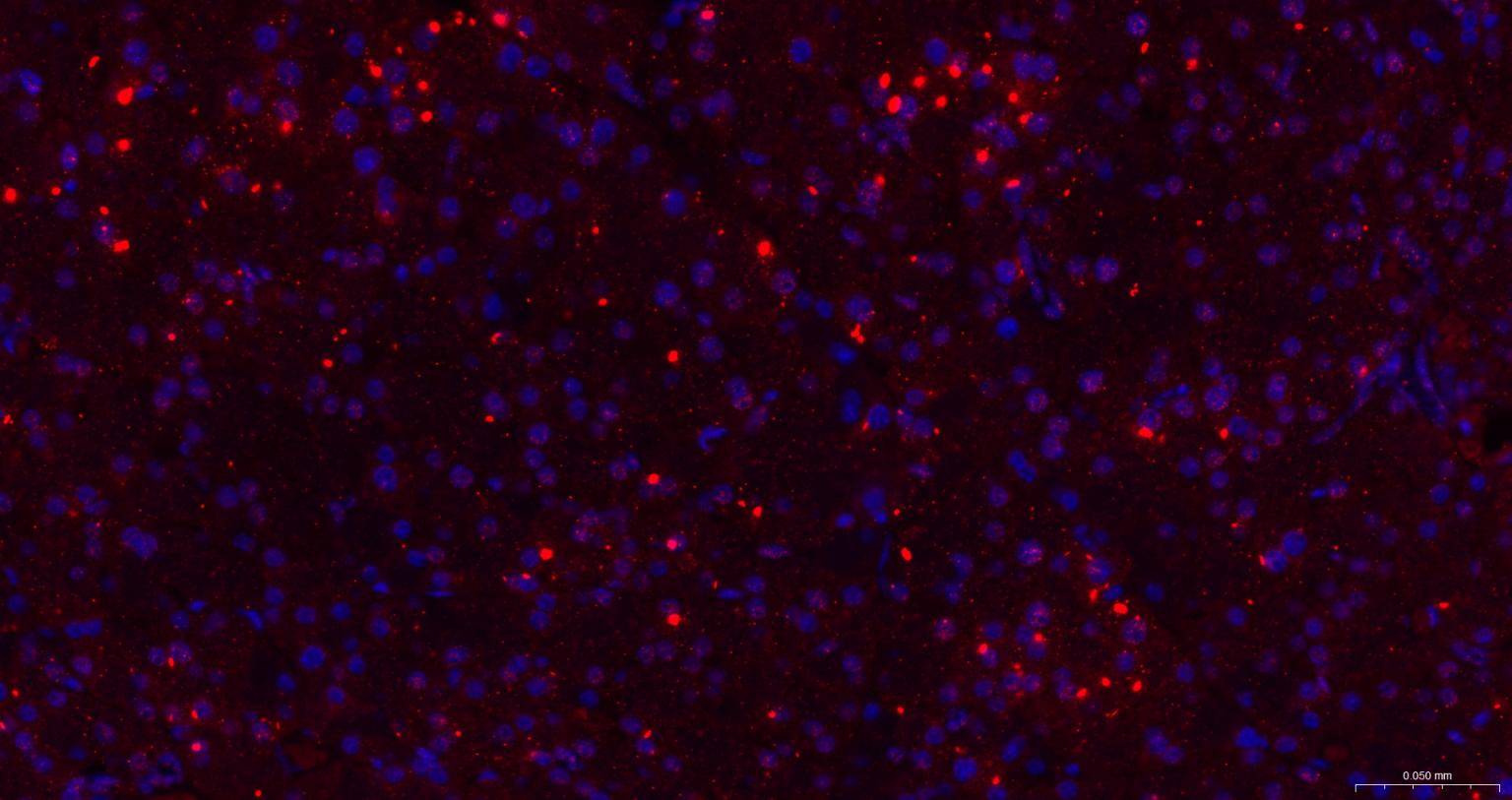 胰岛素基因增强结合蛋白1重组兔单抗