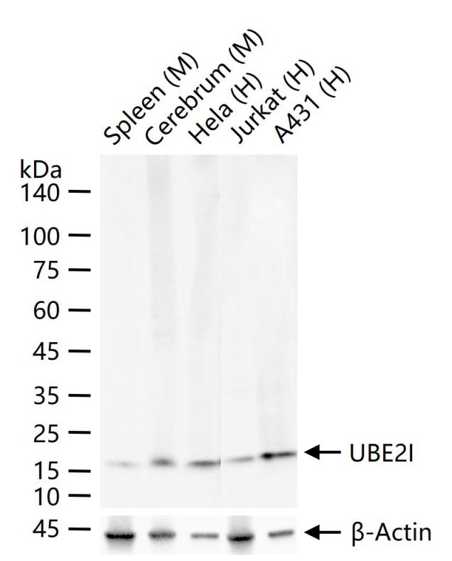 泛素蛋白连接酶E2I重组兔单抗