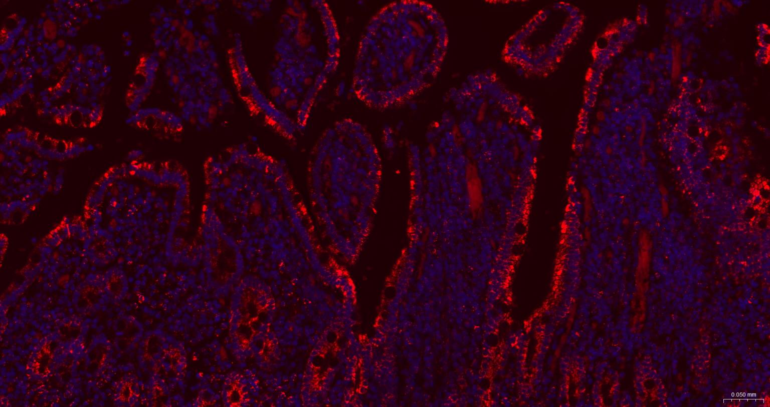 谷氨酰胺酶重组兔单抗
