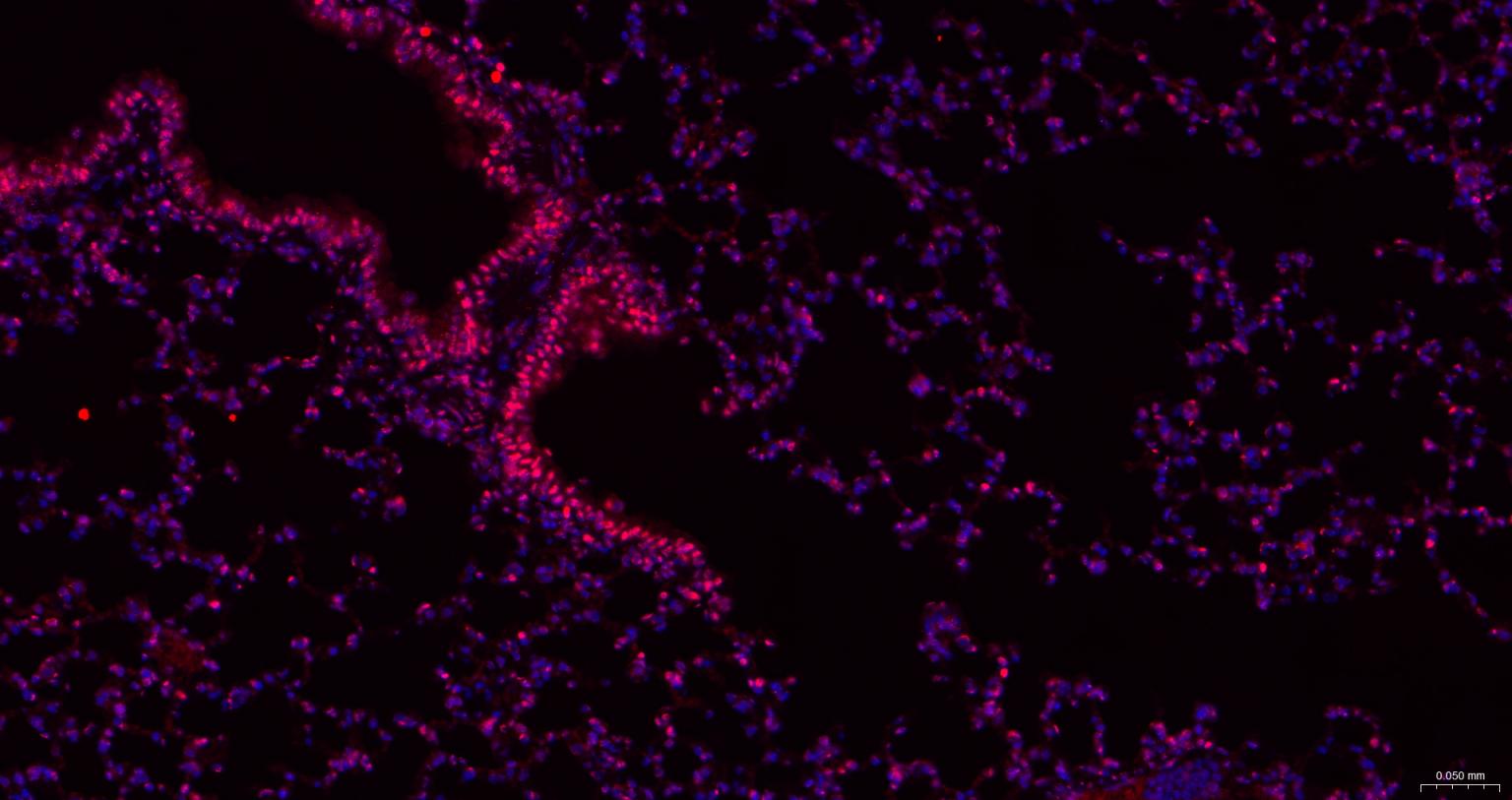 泛素样蛋白Sumo2/3重组兔单抗