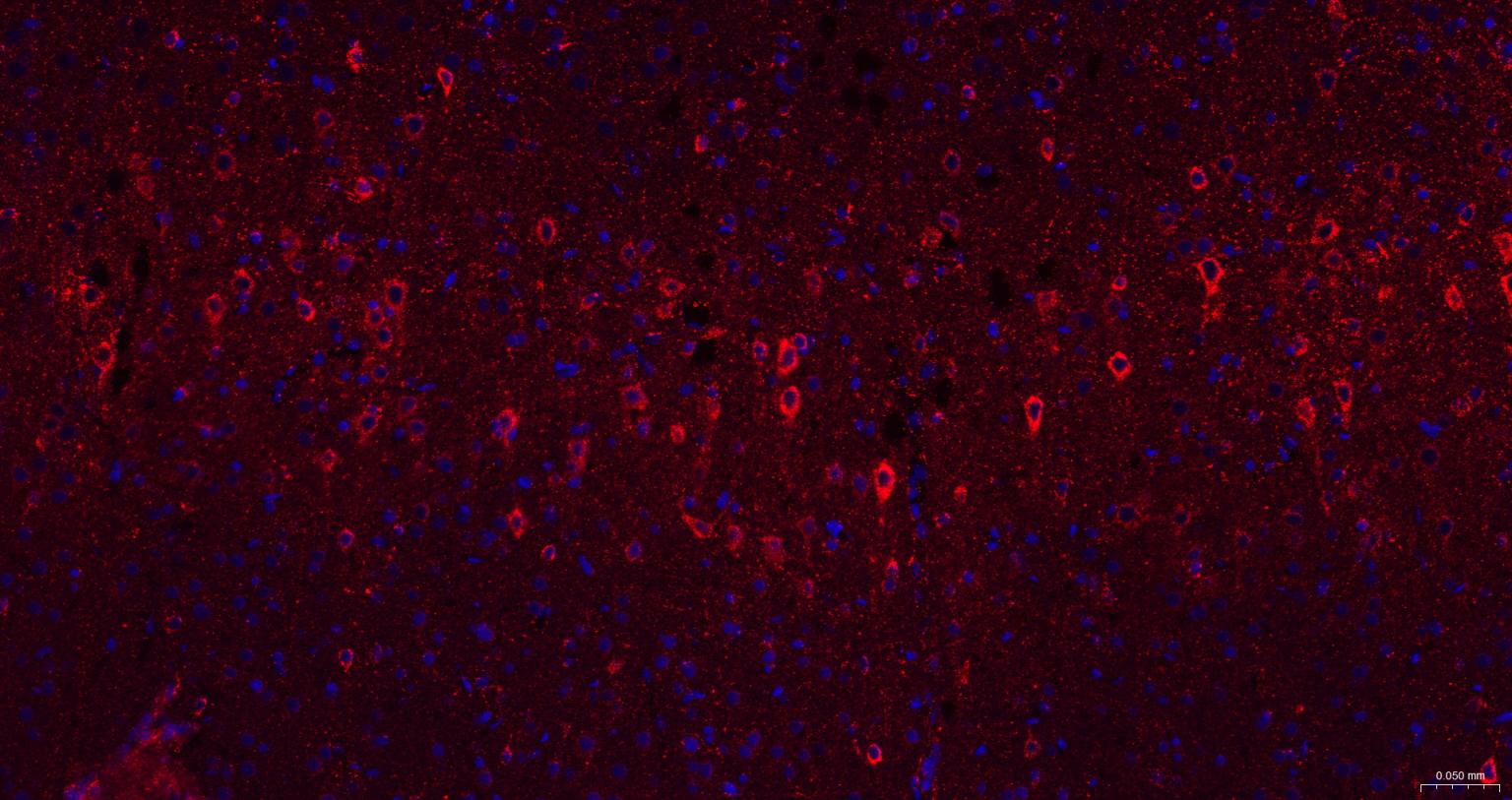 γ氨基丁酸转氨酶重组兔单抗