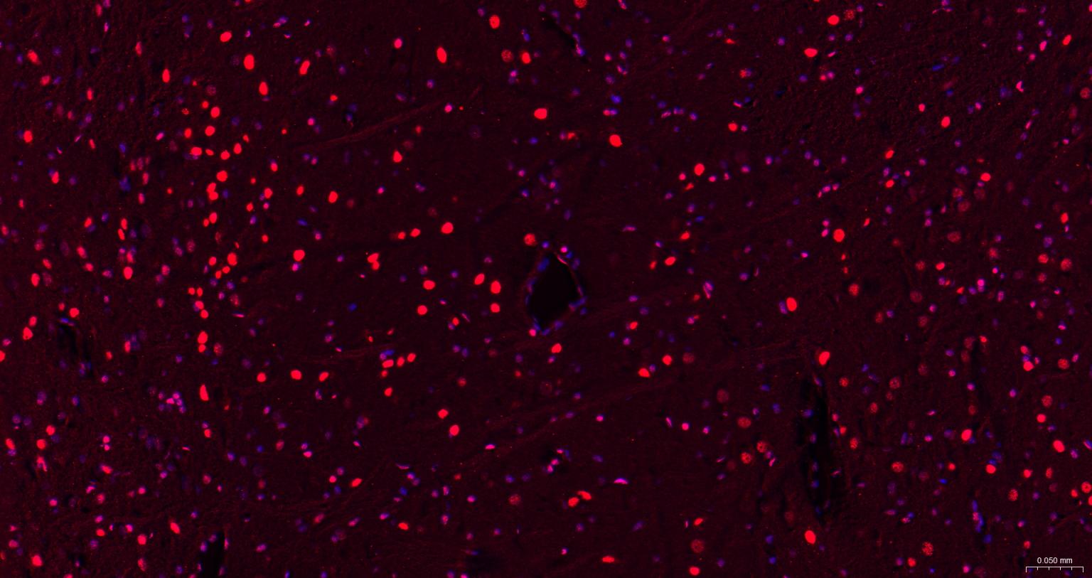 胚胎干细胞关键蛋白1重组兔单抗