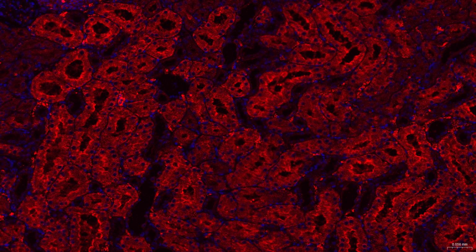 脱帽酶1A重组兔单抗