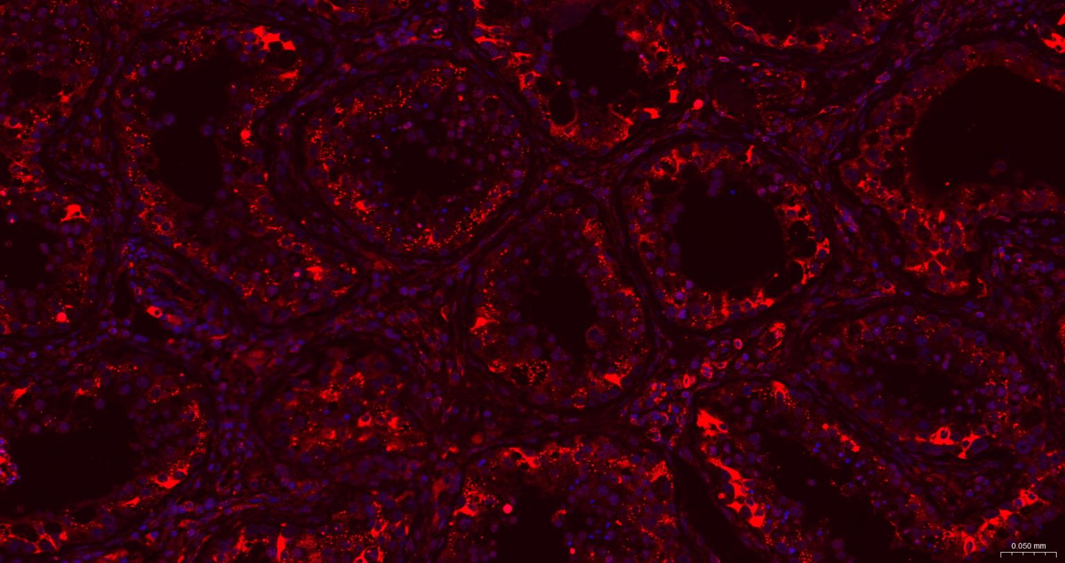 脱帽酶1A重组兔单抗