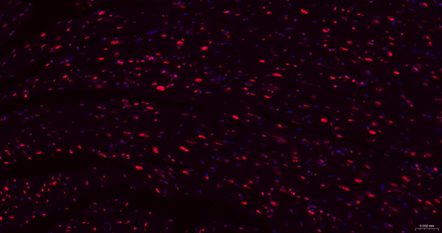 组蛋白H1.0重组兔单抗