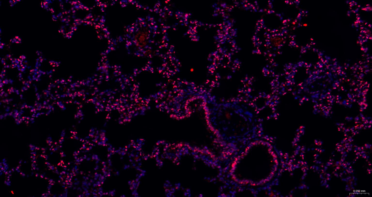 泛素样蛋白Sumo2/3重组兔单抗