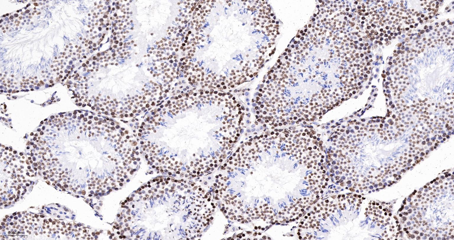 组蛋白H4重组兔单抗